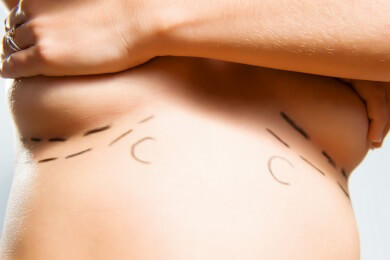 Eine Qual für jede Frau - sichtbare Fehlbildungen in der Brust