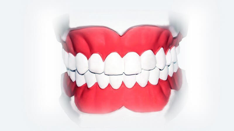 Grafik Gebiss mit weißen gesunden Zähnen