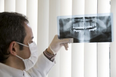 Wurzeltote Zähne durch Endodontie erfolgreich behandeln
