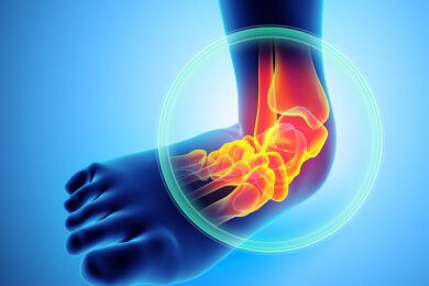 Was man bei einer Sprunggelenksverletzung beachten sollte