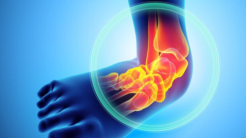 Blaue 3-D-Grafik des Fußes mit Schmerzen im Fußgelenk, rot hervorgehoben und eingekreist