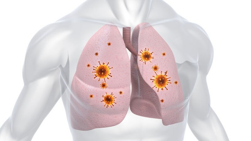 Grafische Darstellung Lungeninfektion