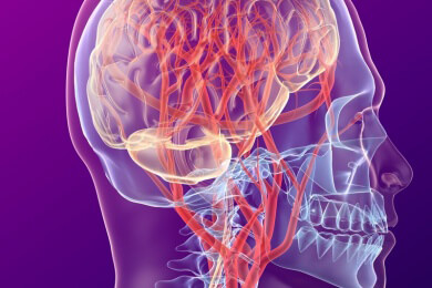 US-Forscher entwickelt neue Alzheimer-Therapie