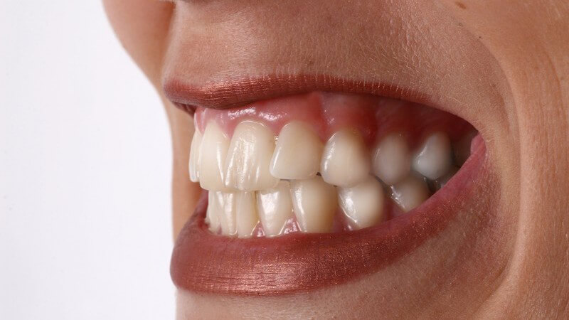 Frauenmund mit geschminkten Lippen, zeigt Zähne, Zähnekirschen
