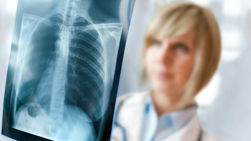 Ärztin schaut Röntgenbild eines Brustkorbs an