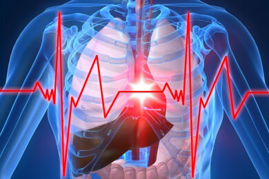 Computertomographische Angiographie (CTA) zeigt Blutgefäße und verringert das Risiko für Herzinfarkt