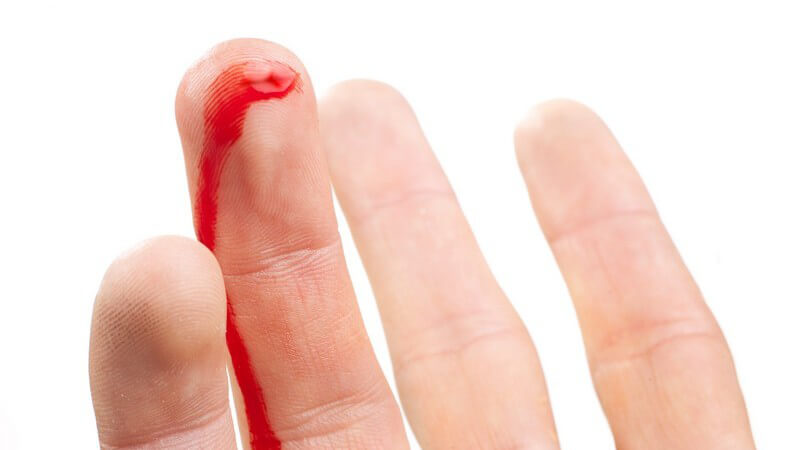 Nahaufnahme Finger einer männlichen Hand, Ringfinger mit blutender Wunde
