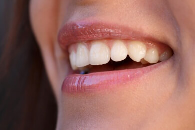 US-Forscher vermuten Zusammenhang zwischen Oberlippenform und weiblichem Orgasmus