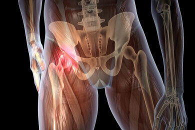 Bei Arthrose sollte man sich bewegen