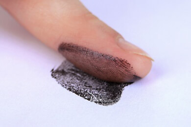 Mutation eines proteinbildenden Gens schuld an fehlenden Fingerabdrücken