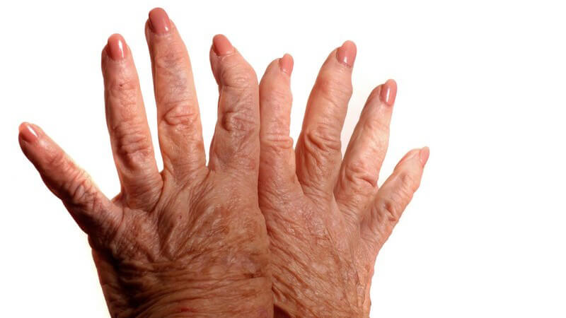 Arthritische Hände auf weißem Hintergrund