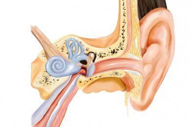 Hörimplantate für Kinder so früh wie möglich einsetzen