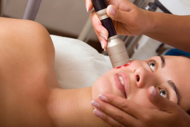 Mit dem Laser Falten behandeln