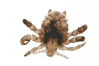 Vorsicht bei Kopfläusen - intensive Haarwäsche reicht nicht