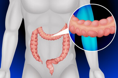 Wie sich die Darmflora durch die Ernährung beeinflussen lässt