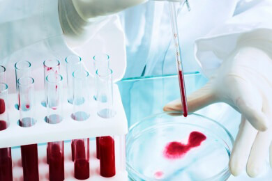 Profile von Micro-RNA im Blut machen 14 häufige Krankheitsbilder testbar