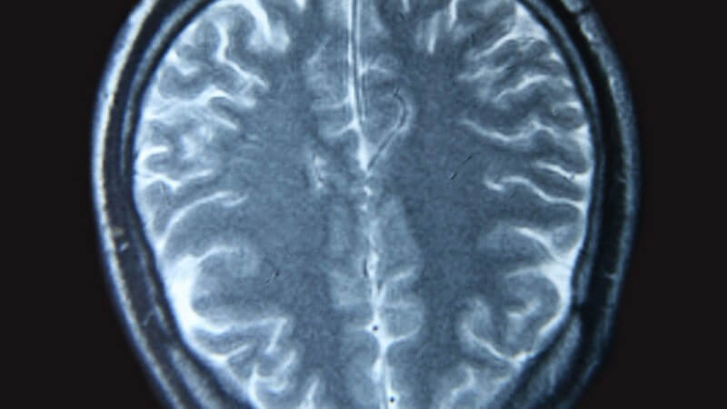 Röntgenbild Kernspintomographie auf schwarzem Hintergrund