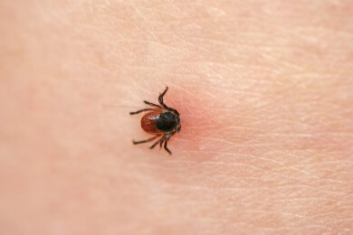 Antibiotika-Pflaster nach einem Zeckenbiss könnte vor Lyme-Borreliose schützen