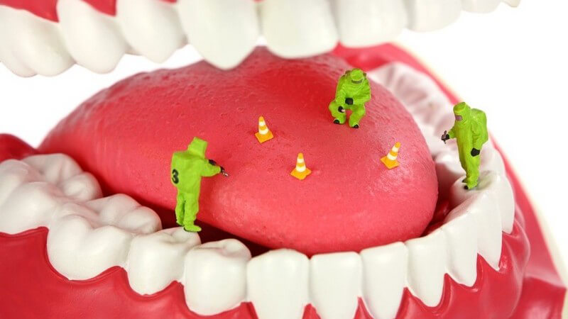 Geöffnetes künstliches Gebiss mit Miniatur-Figuren auf der Zunge, schlechter Atem