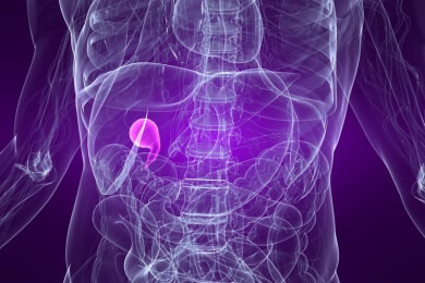 Bei Bauchschmerzen ist eine Cholezystektomie selten sinnvoll