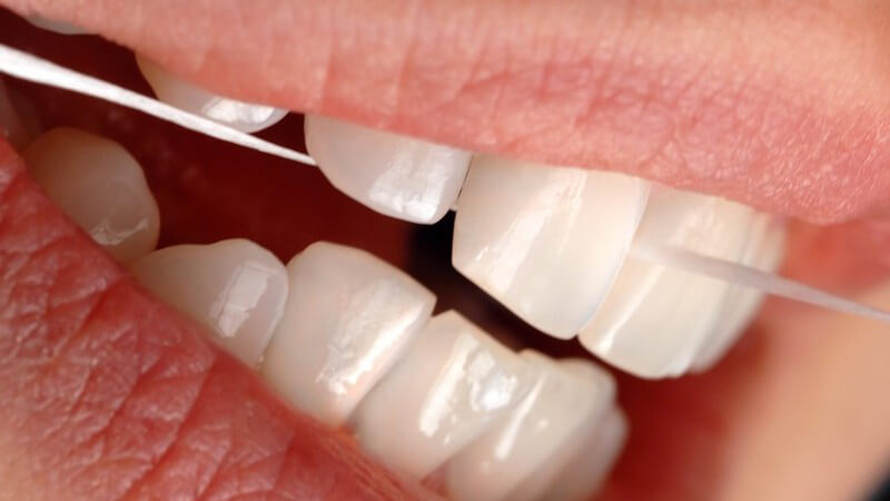 Weiße Zähne, die mit Zahnseide behandelt werden