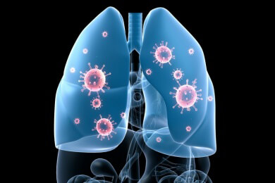 Wieder Sanatorien für Tuberkulose-Kranke?