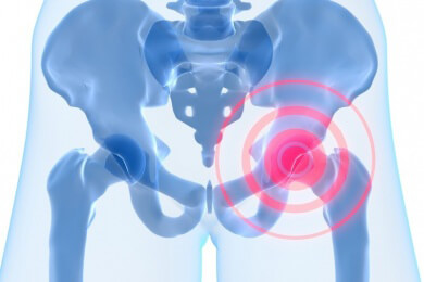 Mit modernen künstlichen Hüftgelenken sogar Sport möglich