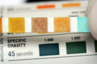 Worauf erhöhte Harnsäurewerte hinweisen können