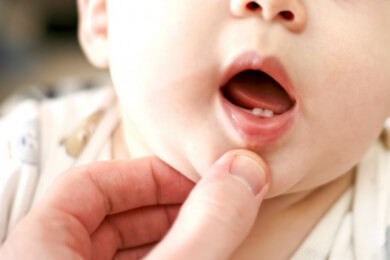 Bereits im Baby-Alter sollte Kariesvorsorge betrieben werden