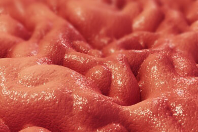 Säureblocker - Hilfe bei chronischer Magenschleimhautentzündung