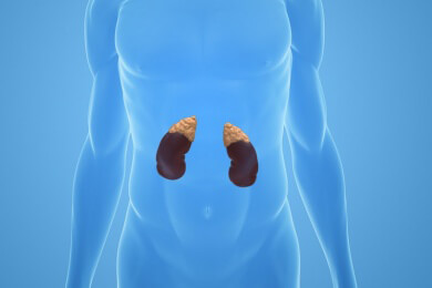 Das Conn-Syndroms - bessere Diagnose ermöglicht schnellere Behandlung