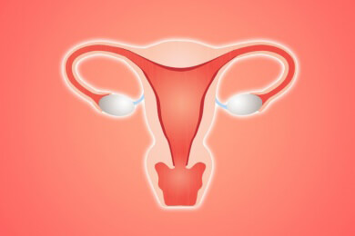 Plötzliche Bauchschmerzen bei Frauen - Grund können verdrehte Eierstöcke sein