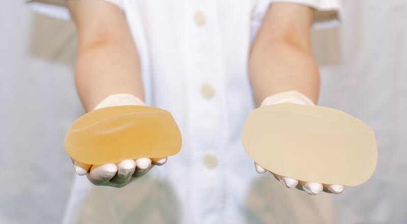 Krankenschwester in weißem Kittel hält zwei unterschiedliche Brustimplantate in den Händen