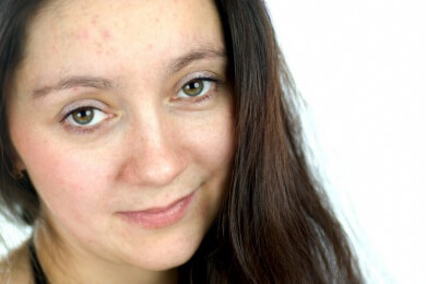 Hautprobleme im Gesicht?