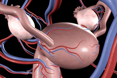Gebärmutterhalskrebs - dank moderner Medizin leben Betroffene heute deutlich länger
