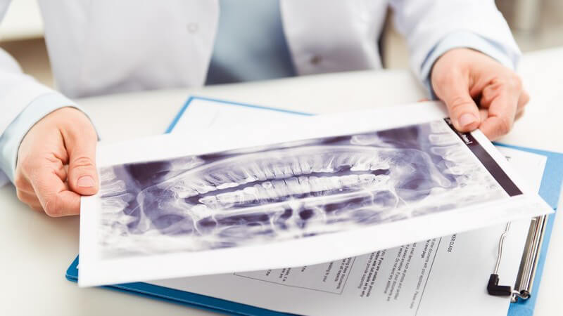 Zahnärztin sitzt am Schreibtisch und betrachtet ein Röntgenbild der Zähne, darunter ein blaues Klemmbrett