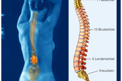 Lumboischialgie - können die schmerzhaften Wirbel durch Steroide beruhigt werden?