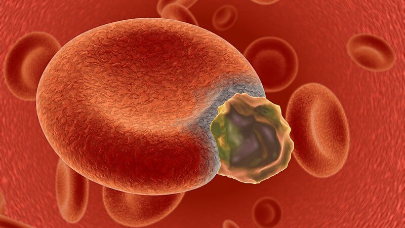 Grafische Darstellung kranke Blutzelle