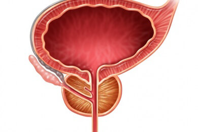 Brustkrebs-Gen lässt bei Männern die Gefahr für Prostatakrebs steigen