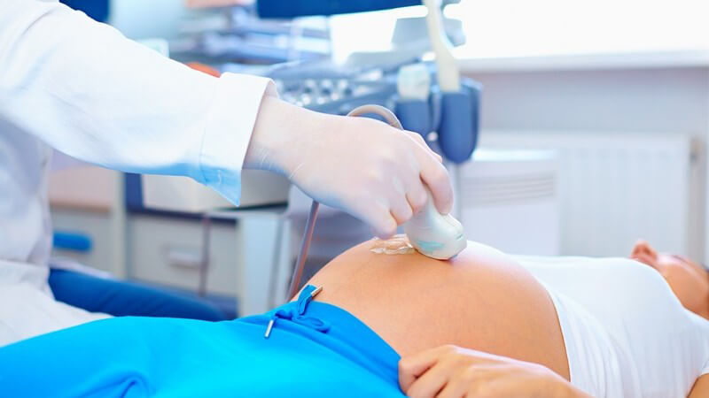 Ultraschalluntersuchung bei einer Schwangeren in weißem Top und blauer Jogginghose