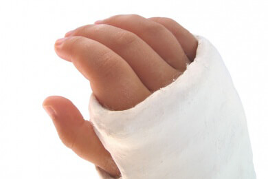 Ein Knochenbruch bei Kindern muss oftmals anderes behandelt werden als beim Erwachsenen