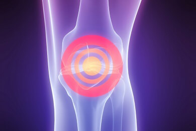 Rheumapatienten atmen dank neuer Therapien auf