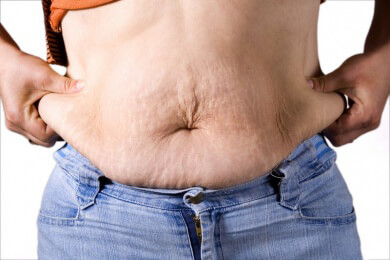 Erhöhtes Risiko für Herz-Kreislauf-Erkrankungen bei Menschen mit Normalgewicht, aber mit Bauchfett