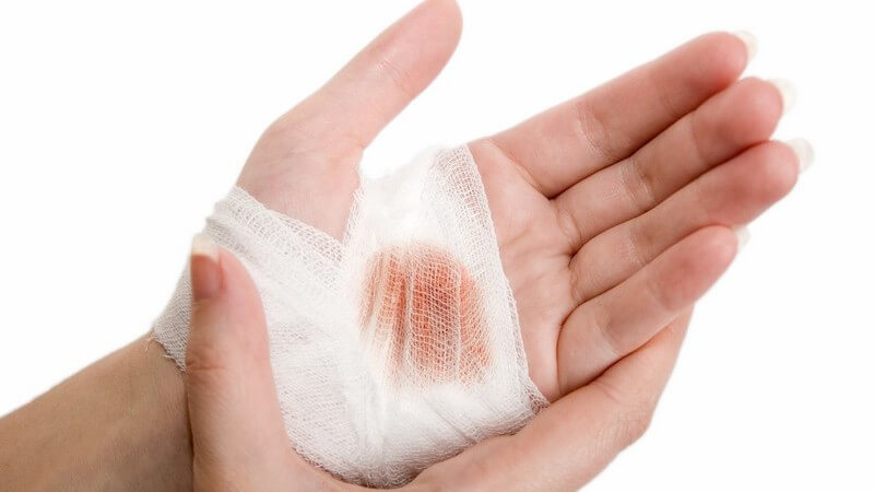 Nahaufnahme bandagierte Frauenhand mit Wunde auf Handfläche