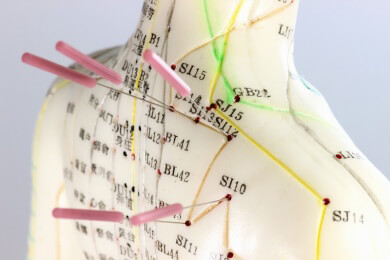 Tests beweisen: Traditionelle chinesische Akupunktur ist erfolgreicher als Scheinakupunktur