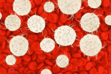 Forscher suchen nach neuen, schonenderen Behandlungsmethoden von Hirnmetastasen