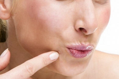 Gesichtshaut mit großen Poren - Wie man dagegen steuern kann und warum eine Behandlung wichtig ist