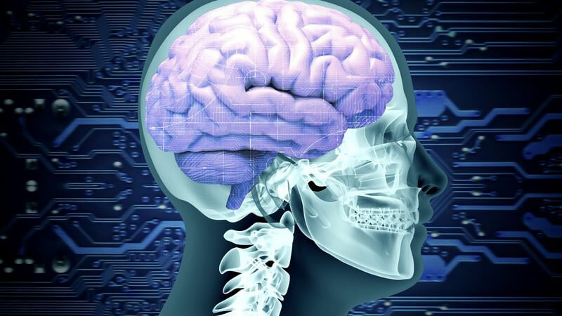 Röntgengrafik eines Schädels mit Gehirn, seitlich vor einem Platinen-Hintergrund