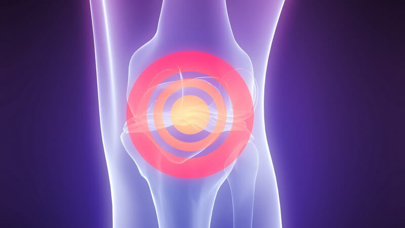 3D Ansicht menschliches Knie, Kniegelenk mit rotem Kreis markiert