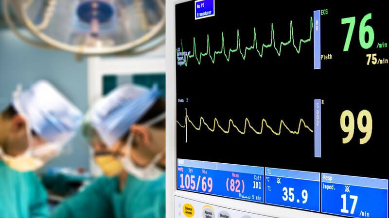 Drei Ärzte in Operationssaal links, unscharf, EKG-Schreiber im Vordergrund mit Herzfrequenz